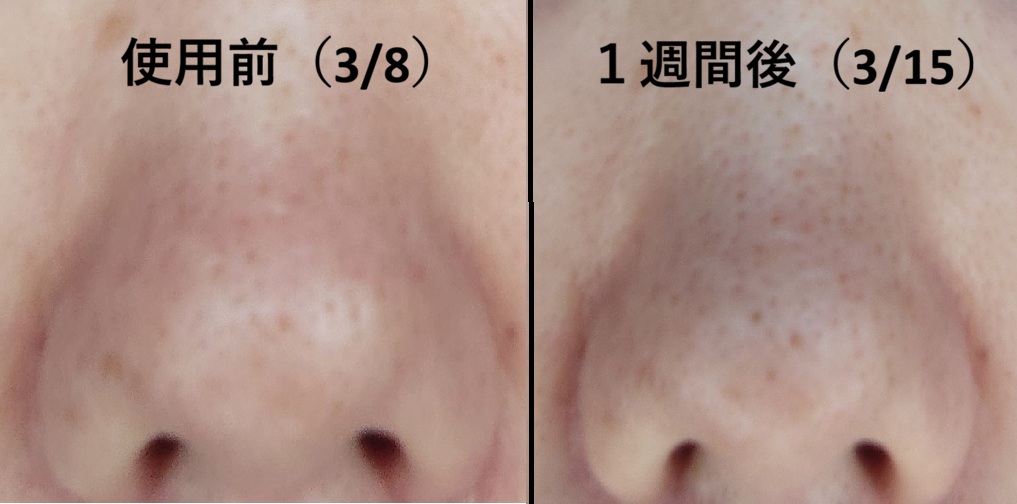 鼻・１週間比較