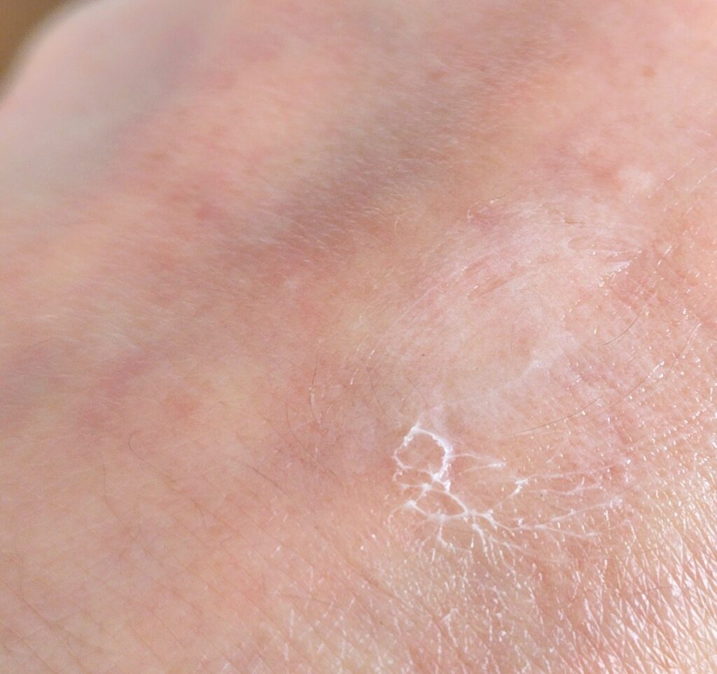 デメランクリーム・手に広げた