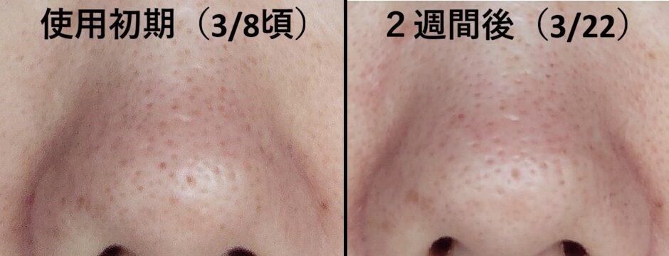 ２週間を比較した鼻の写真