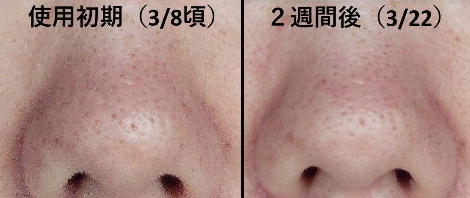 ２週間を比較した鼻の写真